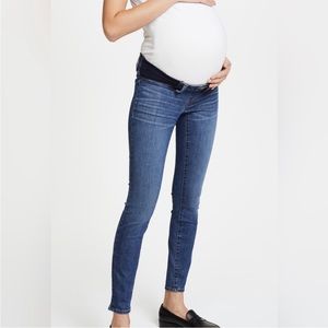 Madewell Maternity Jeans